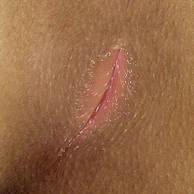 Swinging party in stiles texas Clit stung by bee